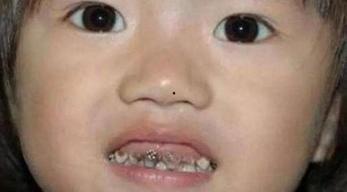 爆牙吃瓜搞笑视频大全集,爆笑集结！爆牙吃瓜搞笑视频大全集欢乐盘点